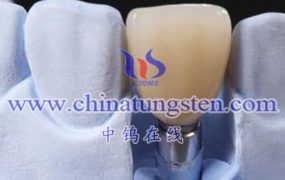 什么是高密度钨合金医疗假体？